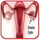 How to Remove an Ovarian Cyst APK