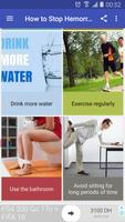 Poster How to Stop Hemorrhoid Pain