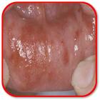How to Heal Mouth Inflammation ไอคอน