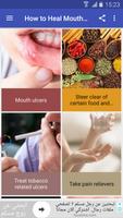 How to Heal Mouth Inflammation ภาพหน้าจอ 2