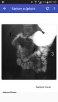 Contrast Media in Radiology 截图 1