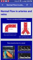 Doppler Ultrasound โปสเตอร์