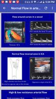 Doppler Ultrasound تصوير الشاشة 1