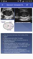 2nd & 3rd trimester OB/GY Ultrasound скриншот 1