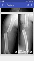 Musculoskeletal X- Rays syot layar 1