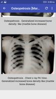 Musculoskeletal X- Rays اسکرین شاٹ 2