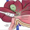 Ultrasound Of Gallbladder