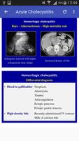 Ultrasound Of Gallbladder скриншот 3