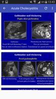 Ultrasound Of Gallbladder скриншот 2