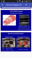 Doppler US Of Carotid arteries скриншот 2