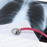 Clinical Chest Radiology アイコン