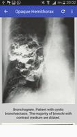 Clinical Chest Radiology تصوير الشاشة 3