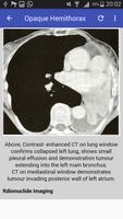 Clinical Chest Radiology الملصق