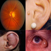 Atlas of Opthalmology & E.N.T