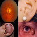 Atlas of Opthalmology & E.N.T