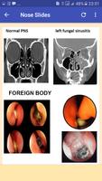 Atlas of Opthalmology & E.N.T capture d'écran 2