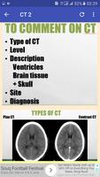 CT Head Basic Interpretation ảnh chụp màn hình 3