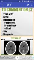 CT Head Basic Interpretation capture d'écran 3