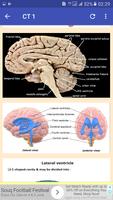 CT Head Basic Interpretation capture d'écran 1