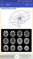 CT Head Basic Interpretation ảnh chụp màn hình 2