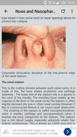 E.N.T-Ear,Nose & Throat screenshot 3