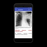 Chest Radiology স্ক্রিনশট 3