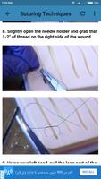Suture Guidelines 截图 2