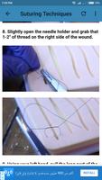 برنامه‌نما Suture Guidelines عکس از صفحه