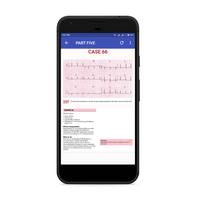 ECG Cases Ekran Görüntüsü 3