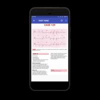 ECG Cases اسکرین شاٹ 1