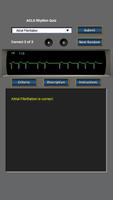 ACLS Rhythm Quiz ảnh chụp màn hình 1