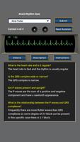 ACLS Rhythm Quiz اسکرین شاٹ 2