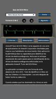 Quiz del ECG Ritmo Affiche