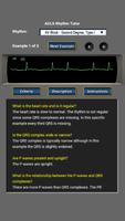 1 Schermata ACLS Rhythm Tutor