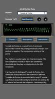 ACLS Rhythm Tutor скриншот 3