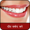 ”दांत सफेद केसे करे : Teeth Whitening Tips Hindi