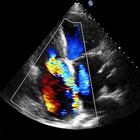 Mobile Heart Ultrasounds icon