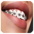 braces photo editor 2018