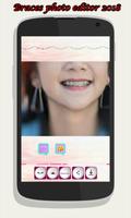 braces photo editor 2018 bài đăng