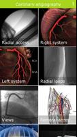 Coronary angiography Affiche