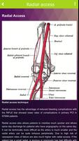 برنامه‌نما Coronary angiography عکس از صفحه