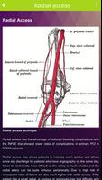 Coronary angiography capture d'écran 1