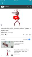 ECMO. capture d'écran 2