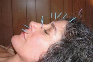 Accupuncture with Android screenshot 1