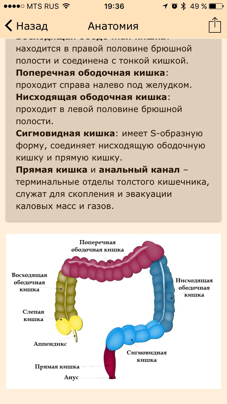 Какая температура в кишечнике человека. Опухоль сигмовидная кишка опухоль. Новообразование ободочной кишки.