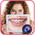 Braces Camera