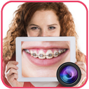 Braces Camera APK