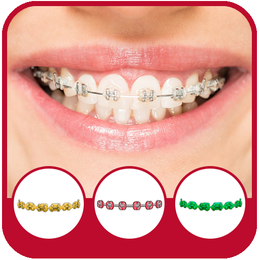 Braces Camera Effects