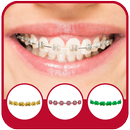 Braces Camera Effects APK