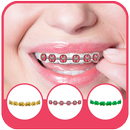 Braces Photo Montage Pro APK